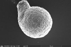 Lesquereusia-spiralis-2