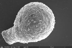 Lesquereusia-spiralis-3