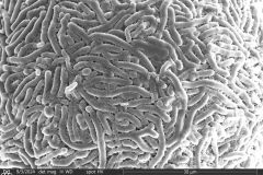 Lesquereusia-spiralis-4