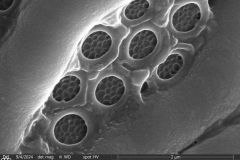 Lesquereusia-spiralis-5