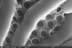 Lesquereusia-spiralis-6