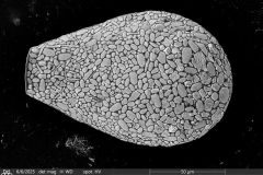 <em>Nebela collaris</em>