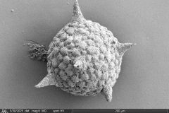 difflugiid_edt_015