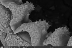 difflugiid_edt_033