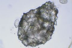 Zivkovicia-stacked-2