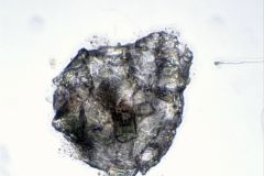 zivkovicia-stacked-3-ps