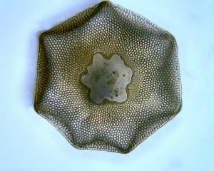 Arcella ventral view 1